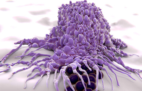 INPACT Inflammation, une offre intégrée en pharmacologie préclinique dans le domaine de l'inflammation