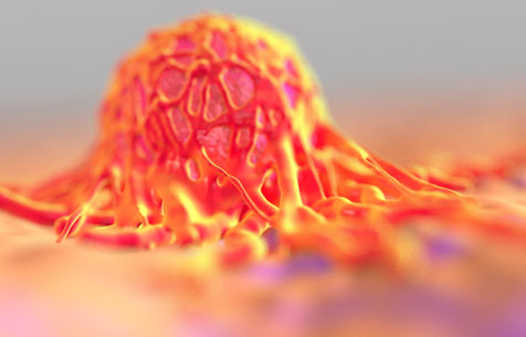 INPACT Oncology, une offre intégrée en pharmacologie préclinique dans le domaine de l'oncologie et l'immuno-oncologie