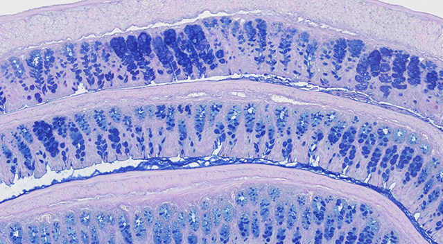 Histology-colitis-model